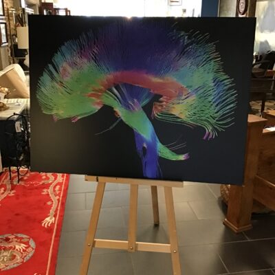 Brain Pathways Diffusion Tensor Imagine Print
