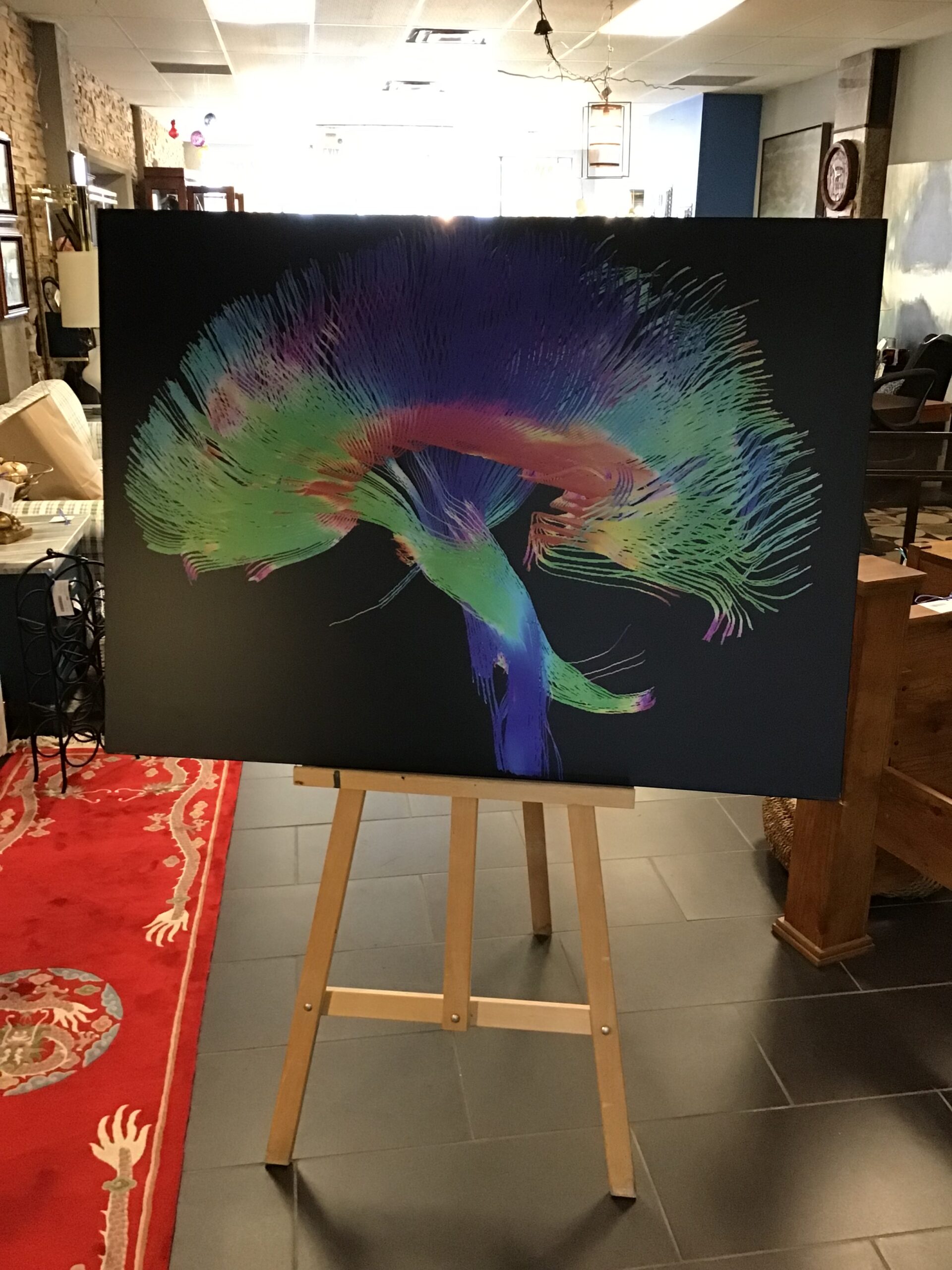 Brain Pathways Diffusion Tensor Imagine Print